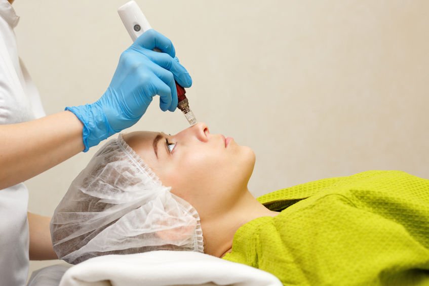 Acne Treatment