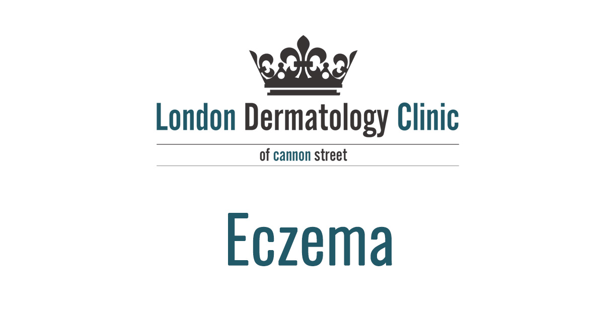 Eczema Treatment (Same Day £195) London Dermatology Clinic