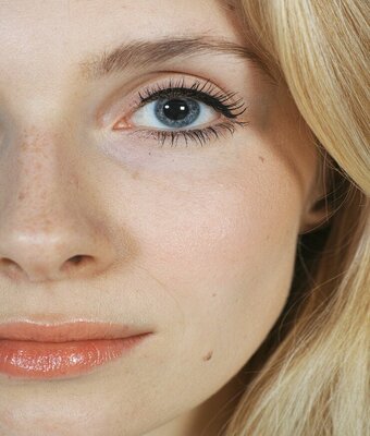 Red Bumps Under The Eyes: Causes and Effective Treatments